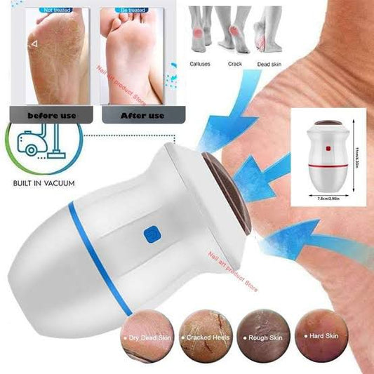 Electric foot grinder | Electric foot callus remover | Electric heel sander